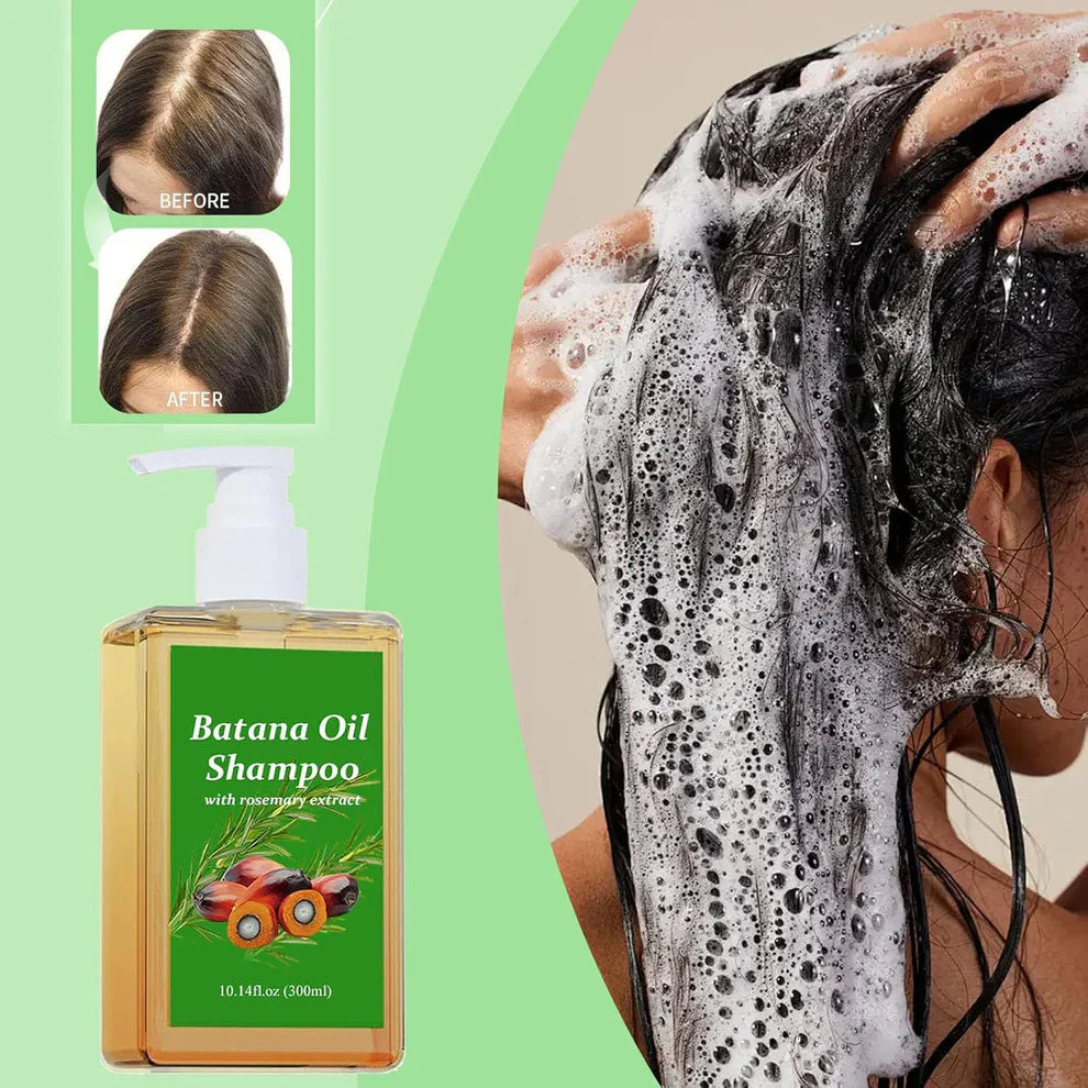 Batana Oil Shampoo for Hair Growth with Rosemary Extract Buy1 Get 1 Free